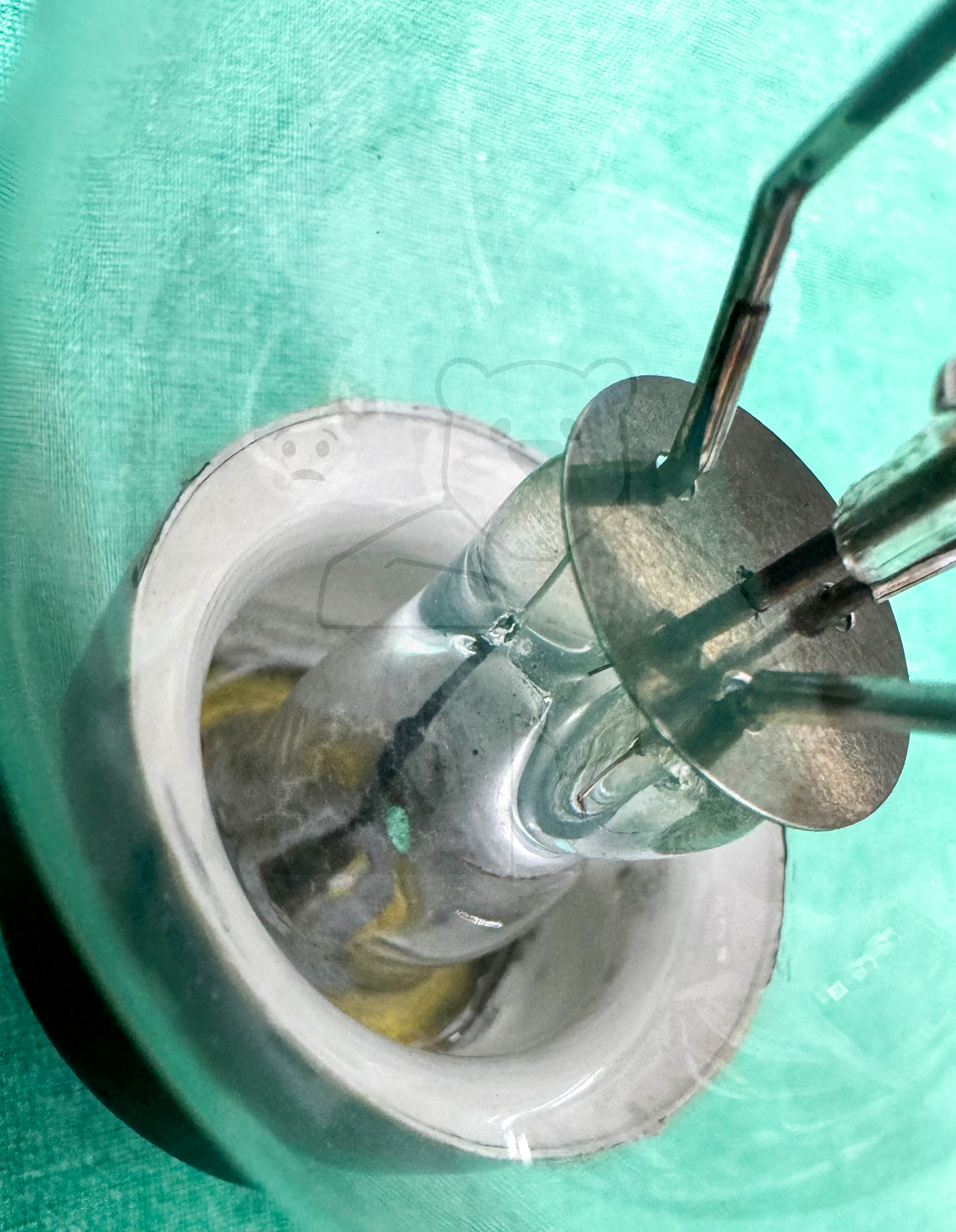 Röhre RS69 IIIg #3649 Bild 33